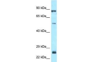 WB Suggested Anti-E2F1 Antibody Titration: 1. (E2F1 anticorps  (Middle Region))