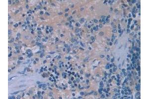 Detection of IL6 in Rat Spleen Tissue using Monoclonal Antibody to Interleukin 6 (IL6)