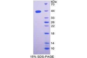 Image no. 1 for Ghrelin (GHRL) (AA 28-117) protein (His tag,GST tag) (ABIN6237916)