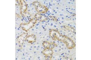 Immunohistochemistry of paraffin-embedded rat kidney using MTERFD3 antibody (ABIN5974877) at dilution of 1/100 (40x lens). (MTERFD3 anticorps)