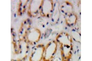 IHC-P analysis of Kidney tissue, with DAB staining. (PKN1 anticorps  (AA 615-874))