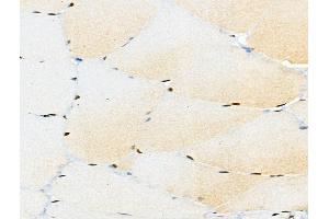 ABIN6256450 and ABIN6267096 at 1/100 staining Rat muscle tissue by IHC-P. (BCL9L anticorps  (pSer915))