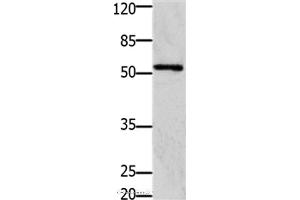 Western blot analysis of 293T cell, using GFRA1 Polyclonal Antibody at dilution of 1:1250 (GFRA1 anticorps)