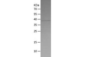 Western Blotting (WB) image for Mitogen-Activated Protein Kinase Kinase Kinase 5 (MAP3K5) (AA 1180-1374) protein (His tag) (ABIN7124004)