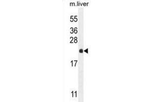 Western Blotting (WB) image for anti-Ribulose-5-Phosphate-3-Epimerase-Like (RPEL1) antibody (ABIN2995143) (Ribulose-5-Phosphate-3-Epimerase-Like (RPEL1) anticorps)