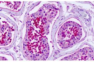 Anti-GPR75 antibody IHC staining of human testis. (GPR75 anticorps  (Extracellular Domain))