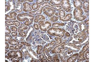 IHC-P Image MCD antibody [N2C1], Internal detects MCD protein at cytosol on mouse kidney by immunohistochemical analysis. (MLYCD anticorps)