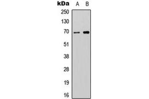 Western blot analysis of ATG16L2 expression in SHSY5Y (A), NIH3T3 (B) whole cell lysates. (ATG16L2 anticorps  (Center))