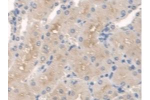Detection of SPTLC1 in Mouse Kidney Tissue using Polyclonal Antibody to Serine Palmitoyltransferase, Long Chain Base Subunit 1 (SPTLC1) (SPTLC1 anticorps  (AA 143-473))