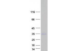 Validation with Western Blot