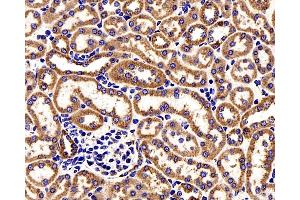Immunohistochemistry analysis of paraffin-embedded Mouse kidney cancer using COX4I1 Polyclonal Antibody at dilution of 1:200. (COX IV anticorps)
