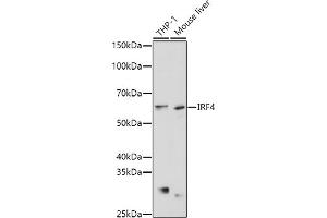 Western blot analysis of extracts of various cell lines, using IRF4 antibody (ABIN1680506, ABIN3015186, ABIN3015187 and ABIN6213873) at 1:1000 dilution. (IRF4 anticorps  (AA 150-350))