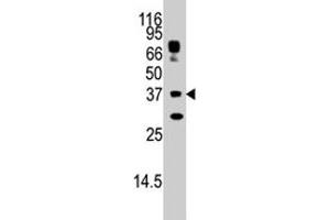 The STUB1 polyclonal antibody  is used in Western blot to detect STUB1 in HepG2 cell lysate. (STUB1 anticorps  (AA 160-190))