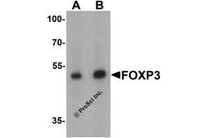 Western Blotting (WB) image for anti-Forkhead Box P3 (FOXP3) (C-Term) antibody (ABIN1077427) (FOXP3 anticorps  (C-Term))
