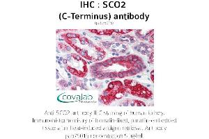 Image no. 1 for anti-SCO2 Cytochrome C Oxidase Assembly Protein (SCO2) antibody (ABIN1739069) (SCO2 anticorps)
