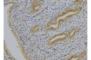 ABIN6277522 at 1/100 staining Human uterus tissue by IHC-P.