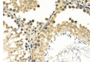 ABIN6261792 and ABIN6266895 at 1/100 staining Rat testis tissue by IHC-P. (FOXJ3 anticorps  (C-Term))