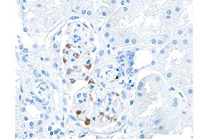 Immunohistochemistry (IHC) image for anti-Tight Junction Protein 1 (TJP1) (AA 650-700) antibody (ABIN7455191) (Recombinant TJP1 anticorps  (AA 650-700))