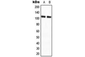 Western blot analysis of CCP2 expression in HepG2 (A), NIH3T3 (B) whole cell lysates. (AGBL2 anticorps  (C-Term))