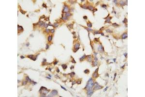 IHC-P: Cystathionase antibody testing of human liver tissue