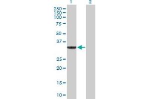 Western Blot analysis of SULT1A3 expression in transfected 293T cell line by SULT1A3 MaxPab polyclonal antibody. (SULT1A3 anticorps  (AA 1-295))