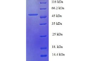 SDS-PAGE (SDS) image for HUS1 Checkpoint Homolog (S. Pombe) (HUS1) (AA 2-280), (partial) protein (His-SUMO Tag) (ABIN5709689)