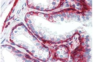 Anti-CD44 antibody IHC staining of human prostate.