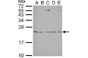WB Image IL1 Receptor antagonist antibody detects IL1RN protein by Western blot analysis.