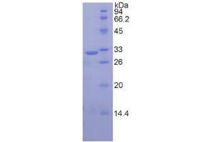 SDS-PAGE analysis of Human CAPN1 Protein.
