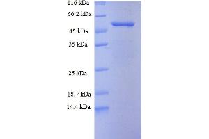 SDS-PAGE (SDS) image for ADAM Metallopeptidase Domain 15 (ADAM15) (AA 207-452), (Extracellular) protein (GST tag) (ABIN5712193)