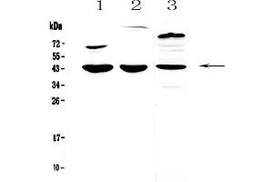 Western blot analysis of IL18 binding protein using anti-IL18 binding protein antibody . (IL18BP anticorps  (AA 29-193))