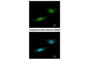 ICC/IF Image Immunofluorescence analysis of paraformaldehyde-fixed HeLa, using NLK, antibody at 1:100 dilution. (Nemo-Like Kinase anticorps)