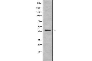 Western blot analysis of WN10B using Jurkat whole cell lysates