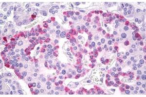 Anti-Glucagon antibody IHC of human pancreas, islets of Langerhans. (Glucagon anticorps  (AA 25-54))