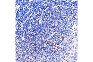 Immunohistochemistry of paraffin-embedded Rat spleen using 4-1BB/CD137 Rabbit pAb (ABIN7271073) at dilution of 1:100 (40x lens).