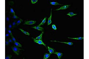 Immunofluorescent analysis of Hela cells using ABIN7147190 at dilution of 1:100 and Alexa Fluor 488-congugated AffiniPure Goat Anti-Rabbit IgG(H+L)