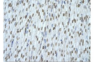 Rabbit Anti-HNRNPAB Antibody       Paraffin Embedded Tissue:  Human cardiac cell   Cellular Data:  Epithelial cells of renal tubule  Antibody Concentration:   4. (HNRNPAB anticorps  (C-Term))