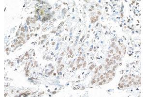 Immunohistochemistry (IHC) image for anti-Protein BANP (BANP) (C-Term) antibody (ABIN7453906)