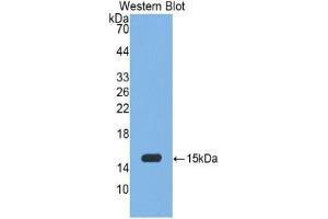 WB of Protein Standard: different control antibodies against Highly purified E. (Myeloperoxidase Kit ELISA)