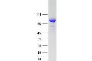 Validation with Western Blot