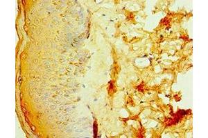 Immunohistochemistry of paraffin-embedded human skin tissue using ABIN7156848 at dilution of 1:100 (IL2 Receptor beta anticorps  (AA 48-177))