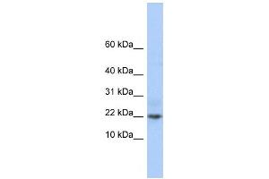 Western Blotting (WB) image for anti-Chromosome 9 Open Reading Frame 25 (C9orf25) antibody (ABIN2459916)