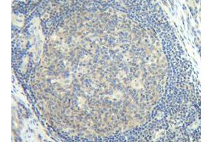 Image no. 3 for anti-Interleukin 2 (IL2) antibody (ABIN181648)