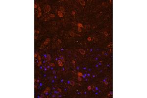 anti-Fibroblast Growth Factor 17 (FGF17) (AA 23-180) antibody