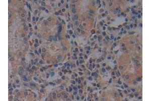 Detection of TLR9 in Human Stomach Tissue using Polyclonal Antibody to Toll Like Receptor 9 (TLR9)