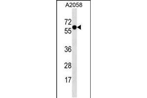 Western blot analysis in A2058 cell line lysates (35ug/lane). (SYT4 anticorps  (N-Term))