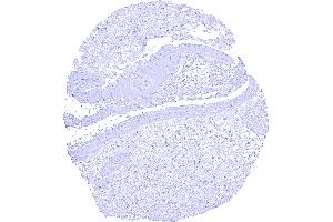 Amnion and chorion cells of the placenta lack KISS1 staining (Recombinant KISS1 anticorps)