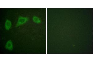 Immunofluorescence analysis of HuvEc cells, using Caveolin-1 antibody. (Caveolin-1 anticorps)