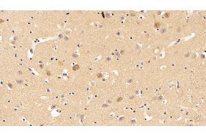 Detection of ADPN in Human Cerebrum Tissue using Polyclonal Antibody to Adiponectin (ADPN) (ADIPOQ anticorps  (AA 108-244))