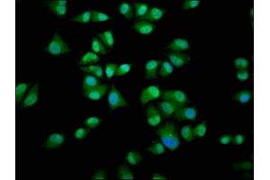 Immunofluorescence staining of Hela cells with ABIN7156289 at 1:200, counter-stained with DAPI. (IMPDH1 anticorps  (AA 191-281))